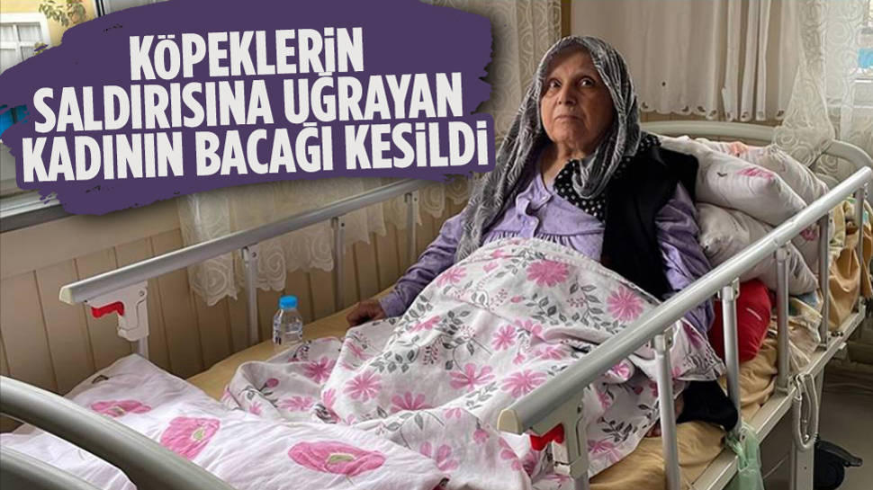 Köpeklerin saldırısına uğrayan kadın bacağını kaybetti