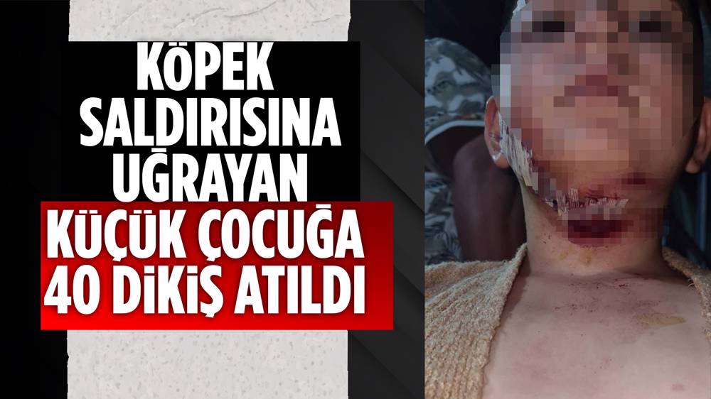 Konya'da köpek saldırısı! 9 yaşındaki çocuk hastanelik oldu 