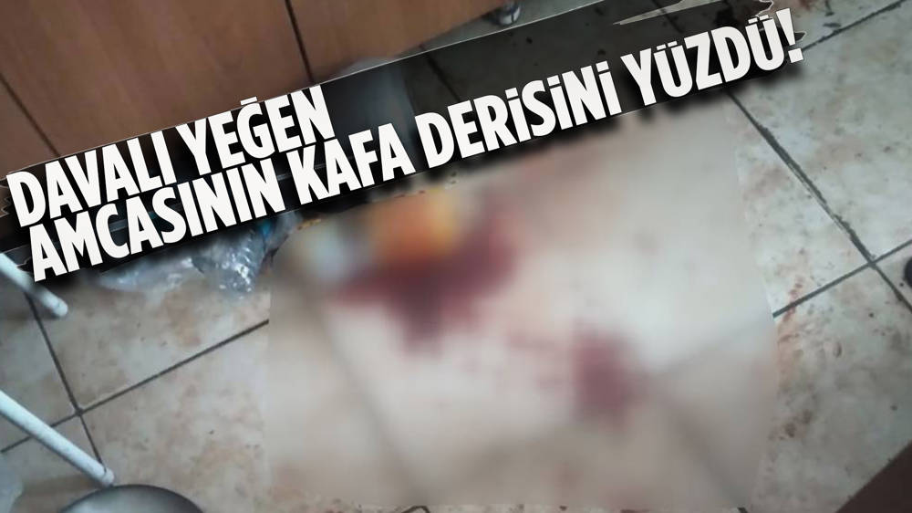 Ankara'da akıl almaz olay! Miras için amcasının kafa derisini yüzdü