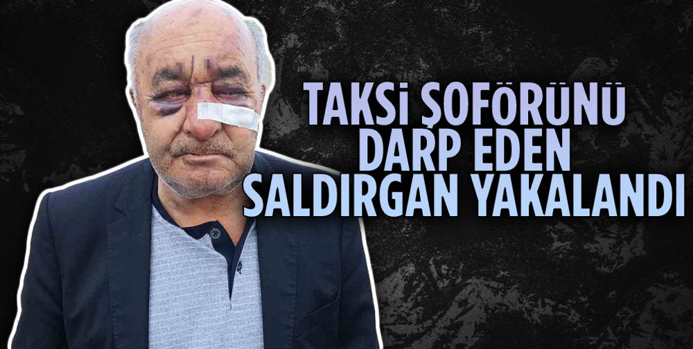 Ankara'da taksiciyi fena halde darp eden saldırgan yakalandı