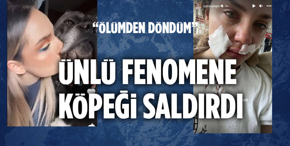 Ünlü fenomene 8 yıldır birlikte yaşadığı köpeği saldırdı