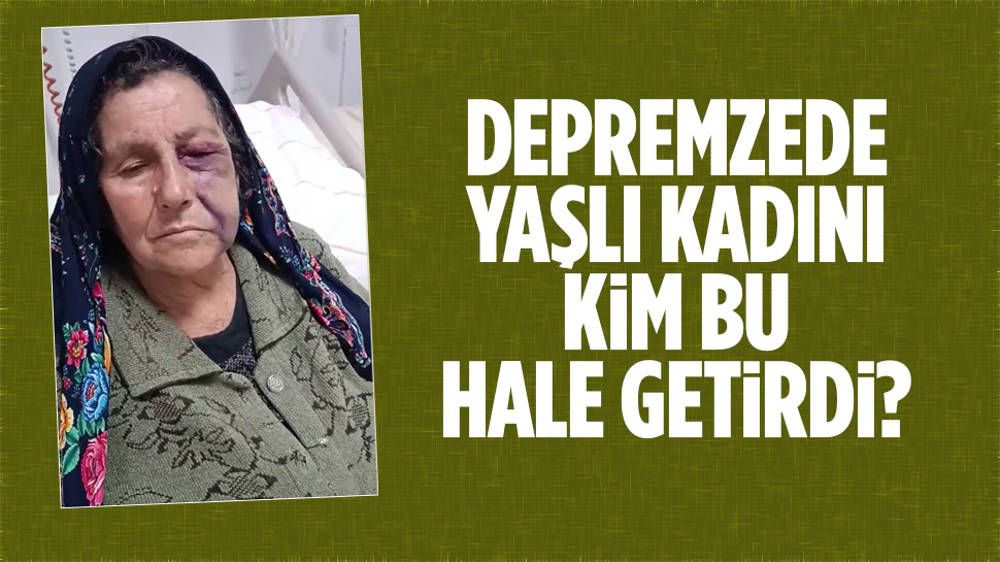 Yaşlı kadını kim bu hâle getirdi?