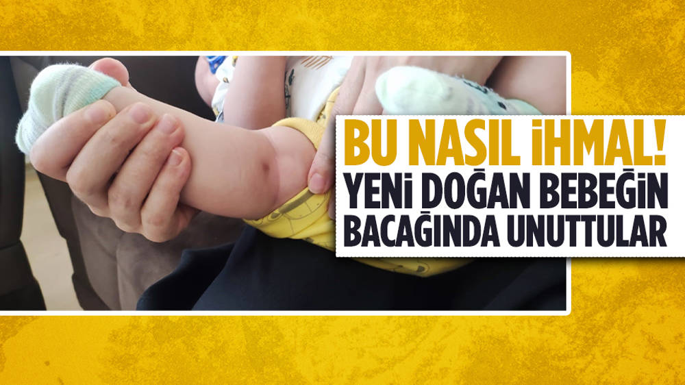 Yeni doğan bebeğin bacağından enjektör iğnesi çıktı