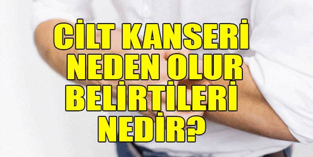 Cilt Kanseri Nedir › Haber Son Dakika Haber En Son Haber 2919