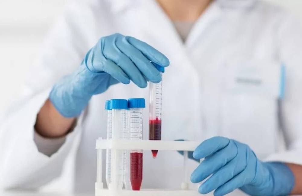 Kanda görülen alerji testi sonuçları nasıl yorumlanır