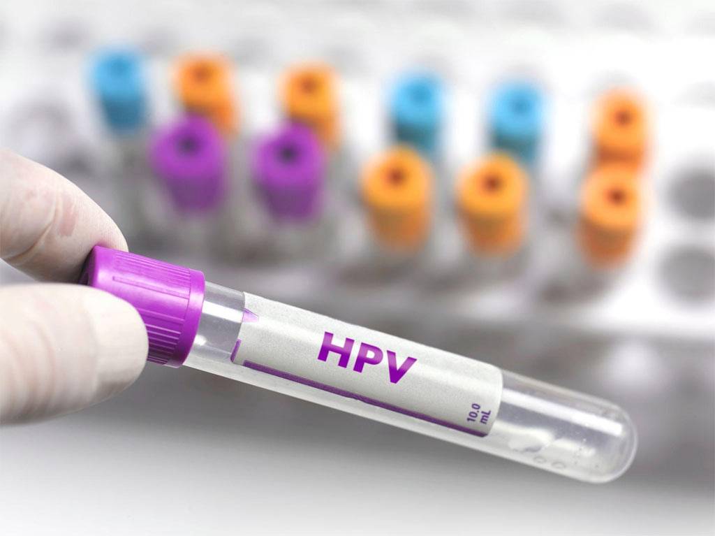 Uzmandan HPV aşısına dair açıklama: Birçok kanser türünden koruyor!