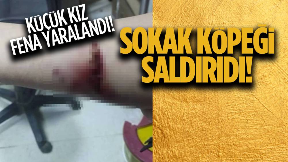 Küçük kız çocuğu evine giderken sokak köpeklerinin saldırısına uğradı!