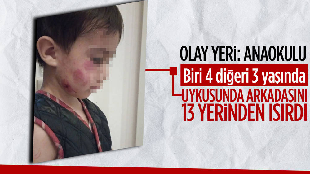 Anaokulunda 4 yaşındaki çocuk, 3 yaşındaki çocuğu uyurken 13 yerinden ısırdı; aile şikayetçi oldu