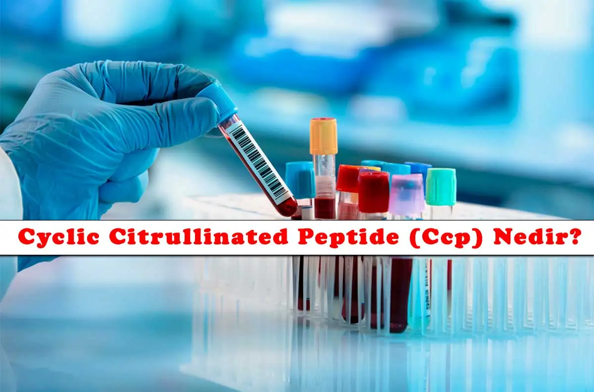 Cyclic Citrullinated Peptide (Ccp) Nedir?