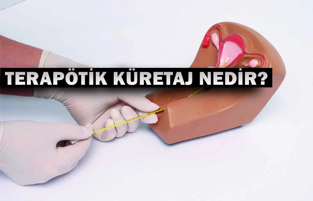 Terapötik Küretaj Nedir?