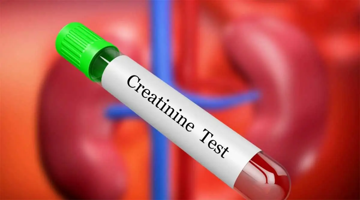 Kreatin Düşüklüğü Nedir?