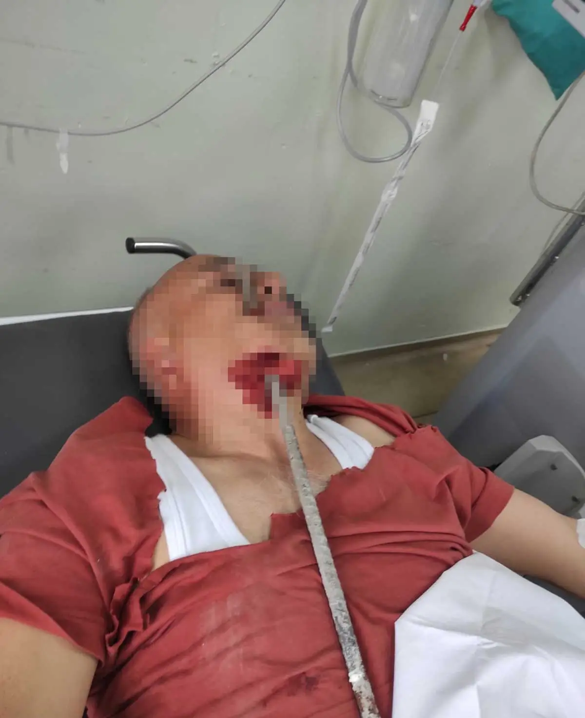 Şantiyede feci kaza: Demir boynundan girip yanağından çıktı
