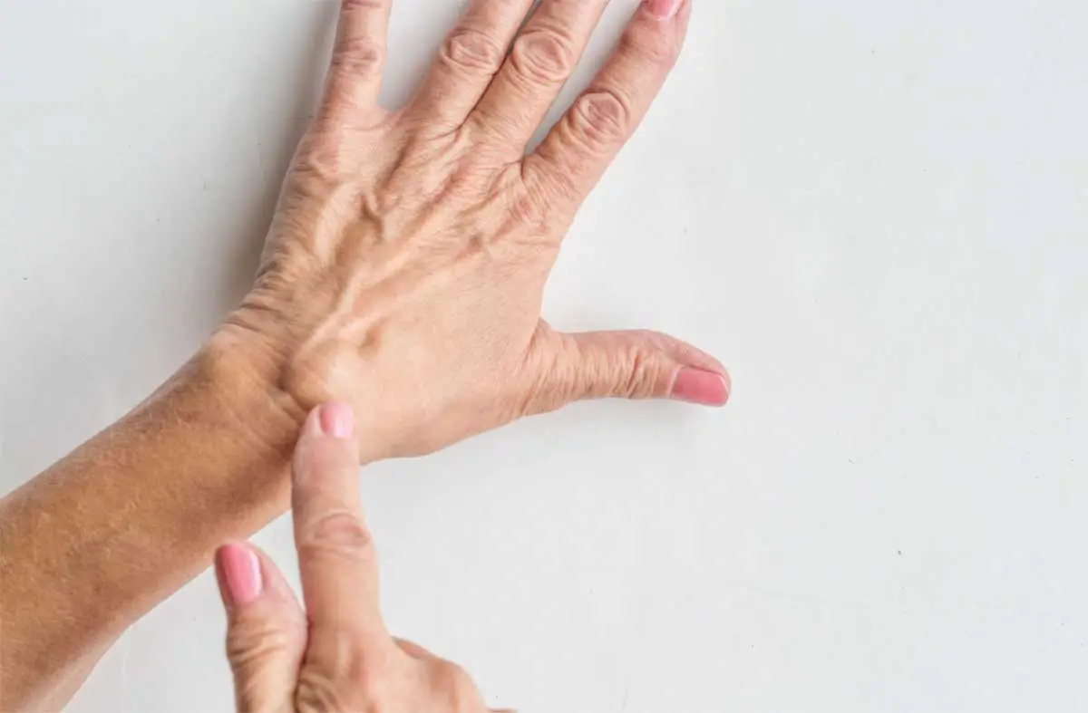 Ganglion Kisti Evde Nasıl Tedavi Edilir?