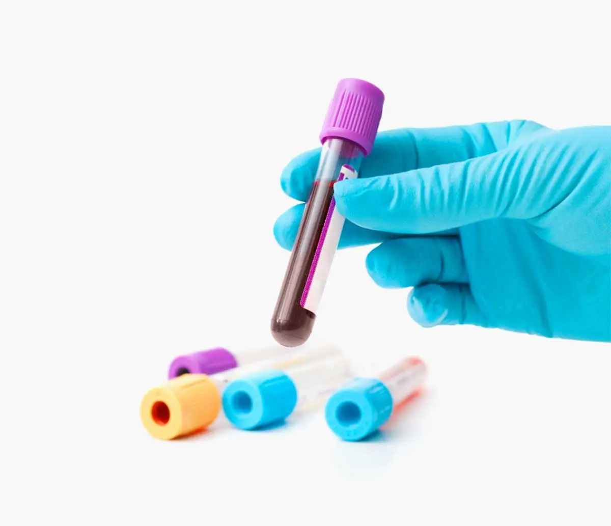 Hemogram Eos Nedir?