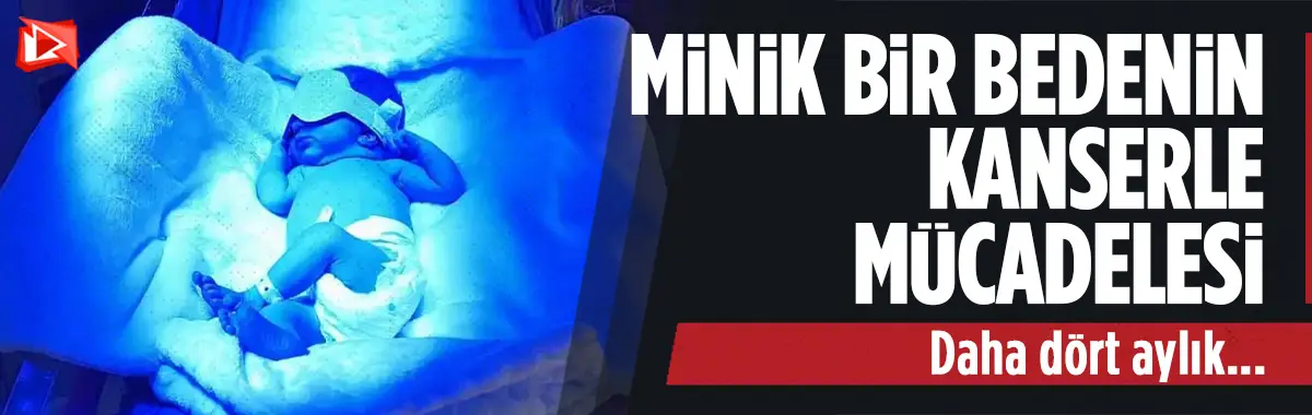 4 aylık minik bir bedenin kanserle mücadelesi...